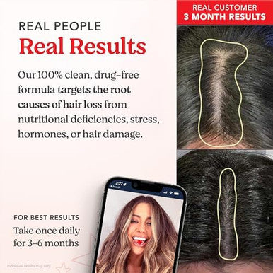 HAIRtamin Gummy Stars Hair Vitamins with Biotin Month Supply