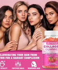 2-Pack Collagen Gummies For Women & Men - With Biotin, Vitamin C, & Zinc For Skin Radiance, Hair Growth, Strong Nails, & Joint Support, 120 Count