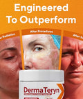 Marie Originals Dermateryn Sunburn & Post Radiation Cream Natural Moisture Barrier For Dry Irritated Or Sensitive Skin Zinc Oxide + Lanolin Petroleum Fragrance 4 Oz