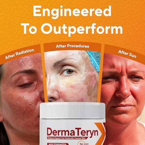 Marie Originals Dermateryn Sunburn & Post Radiation Cream Natural Moisture Barrier For Dry Irritated Or Sensitive Skin Zinc Oxide + Lanolin Petroleum Fragrance 4 Oz