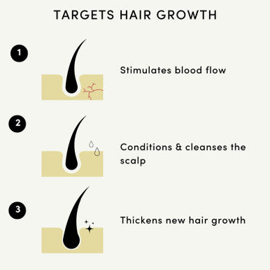 Forest & Shore Hair Growth Oil 100% Natural Hair Oil with Caffeine Biotin Castor Oil Argan Oil Coconut Oil and Rosemary Oil Effective Thickening Mask & Hair Loss Treatment