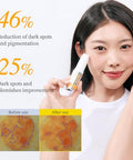 Yadah Vitamin C 30 Correcting Balm (0.35Oz) ÃƒÂ¢Ã¢â€šÂ¬Ã¢â‚¬Å“ All-In-One Multi Care For Dark Spot Remover, 30% Pure Ascorbic Acid & Vitamin E For Radiant Nourished Skin, Starter & Finishing Balm And Skin Brightening