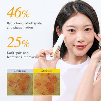 Yadah Vitamin C 30 Correcting Balm (0.35Oz) ÃƒÂ¢Ã¢â€šÂ¬Ã¢â‚¬Å“ All-In-One Multi Care For Dark Spot Remover, 30% Pure Ascorbic Acid & Vitamin E For Radiant Nourished Skin, Starter & Finishing Balm And Skin Brightening