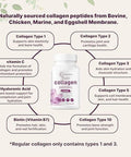 Micro Ingredients Multi Collagen Complex For Women & Hair Vitamins Complex Capsules Bundle 2 Pack Grassfed Collagen Peptides 14In1 Advanced Hair Growth Support