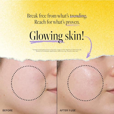 Derma E Vitamin C Glow Face Oil 1 Fl Oz Nourishes Brightens And Illuminates For Radiant Skin Moisturizing Vitamin C Oil With Turmeric Seabuckthorn And Red Raspberry