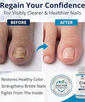 Biodora Oral Probiotic Antifungal Pills - Extra Strength Nail Fungus Eliminator | Toenail Fungal Inhibitor - Clear Nails Supplement | 50 Billion Cfu (60 Capsules)