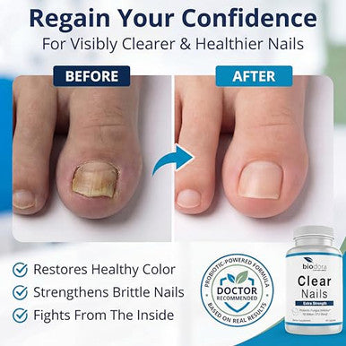 Biodora Oral Probiotic Antifungal Pills - Extra Strength Nail Fungus Eliminator | Toenail Fungal Inhibitor - Clear Nails Supplement | 50 Billion Cfu (60 Capsules)