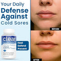 Clear Probiotics Lysine Cold Sore Treatment For Lips With Pre Probiotics & Vit