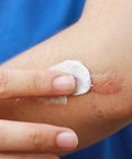 Julphar Pharma Mebo Scar Ointment (30G)