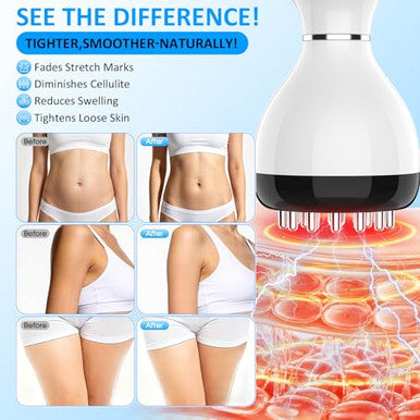 Connova Lym-Phatic Dr-Ainage Massager -Body Scul-Pting Machine With 30-Level Micro-Current Light Heat & Vib-Ration For Legs Arms & Belly Body Helps Reduce Str-Etch Marks & Cell-Ulite