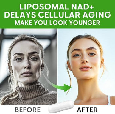 Liposomal Nad+ Supplement 500 Mg, With Tmg 250 Mg, Boost Nad+ High Absorption For Cellular Energy And Age Resist-120 Capsules