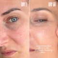 Ma lys Super Charged Liquid Collagen For Women - Collagen Peptides Supplement With Biotin For Hair Skin And Nails - Liquid Hydrolyzed Collagen Peptides