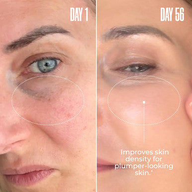 MaÃƒÆ’Ã‚Â«lys Super Charged Liquid Collagen For Women - Collagen Peptides Supplement With Biotin For Hair Skin And Nails - Liquid Hydrolyzed Collagen Peptides