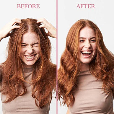 Umberto Giannini Scalp Restore Balancing Conditioner Vegan and Cruelty Scalp Reviving Formula With Coconut Oil and Vitamin E 8.5Fl Oz