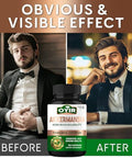 OYIR 300 Billion Afu Akkermansia Probiotic Glp 1 Probiotic Akkermansia Muciniphila Supplement Support Digestive, Immune, Overall Health For Men and Women Enhances Gut Lining Function
