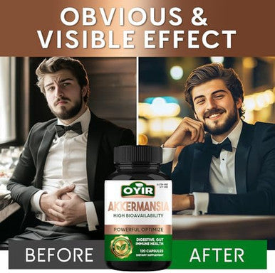 OYIR 300 Billion Afu Akkermansia Probiotic Glp 1 Probiotic Akkermansia Muciniphila Supplement Support Digestive, Immune, Overall Health For Men and Women Enhances Gut Lining Function