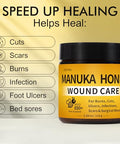 Manuka Honey for Wounds, Speed up Healing for Cuts, Surgical Wounds, Scars, Foot Ulcers, Infection, Burns, Non-Sticky, No Crystallization, Easy to Apply, 3.88 oz