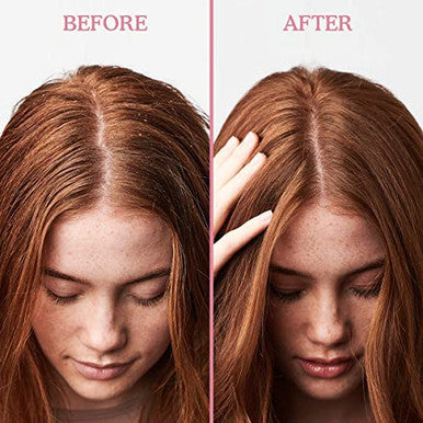 Umberto Giannini Scalp Restore Balancing Conditioner Vegan and Cruelty Scalp Reviving Formula With Coconut Oil and Vitamin E 8.5Fl Oz