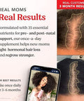HAIRtamin MOM Prenatal and Postnatal Hair Vitamins