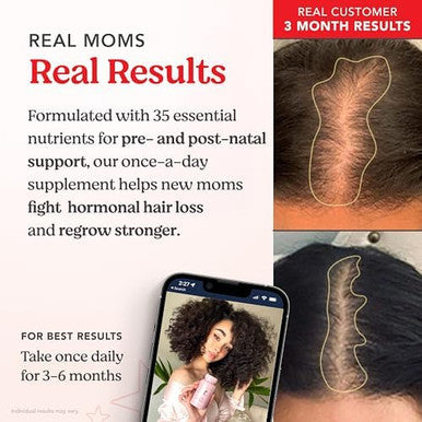 HAIRtamin MOM Prenatal and Postnatal Hair Vitamins