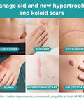 Dimora Waterproof Silicone Scar Sheets - Medical Grade Silicone Scar Tape (1.6 X120" Roll), Ultra-Thin Scar Removal Treatment For Surgical Scars, C Section, Tummy Tuck, Keloid Treatment