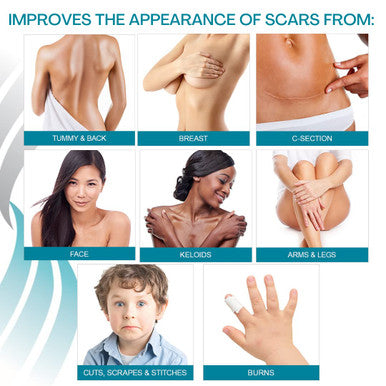 Newgel+ Advanced Silicone Professional Scar Treatment Sheeting 1 Mm Thick For Areola, Post Surgery Cosmetic Procedure, 1 Pair (2 Count) Per Box - Clear