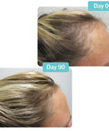 Viviscal PRO Hair Growth Supplement for Men & Women Supports Thinning Hair Promotes Thickness & Fullness with Marine Complex Iron Zinc & Vitamin C 60 Tablets