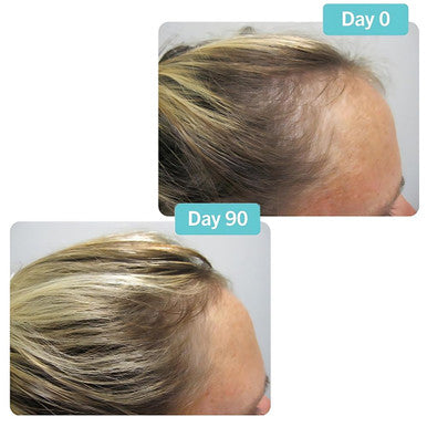 Viviscal PRO Hair Growth Supplement for Men & Women Supports Thinning Hair Promotes Thickness & Fullness with Marine Complex Iron Zinc & Vitamin C 60 Tablets