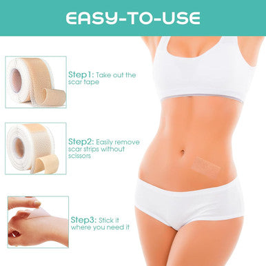 Medical Grade Soft Silicone Tape For Scar Removal (1''X 120'') Scar Treatment, 1 Roll 180Cm With 5Cm Crease Silicone Scar Sheets, Keloid Bump Removal Easy To Tear Without Scissors