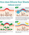 Dimora Waterproof Silicone Scar Sheets - Medical Grade Silicone Scar Tape (1.6 X120" Roll), Ultra-Thin Scar Removal Treatment For Surgical Scars, C Section, Tummy Tuck, Keloid Treatment