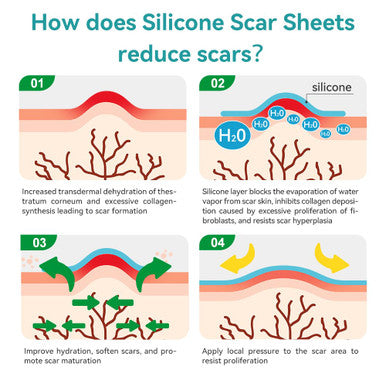 Dimora Waterproof Silicone Scar Sheets - Medical Grade Silicone Scar Tape (1.6 X120" Roll), Ultra-Thin Scar Removal Treatment For Surgical Scars, C Section, Tummy Tuck, Keloid Treatment