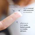 Scaraway Acne Scar Treatment, Clear Silicone Scar Gel, 100% Medical-Grade, Helps Improve Size, Color & Texture Of Post-Acne Hypertrophic & Keloid Scars On Face & Body, Water Resistant, 15 Grams