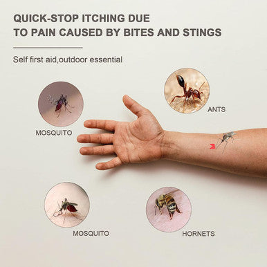 Bug Bite Thing Suction Tool Venom Extractor ZeChok Electronic Mosquito After Bite Sucks Venom, No Antipruritic and Chemical Suitable for Outdoor Camping with 3 Replaceable Tips and Washable (White)