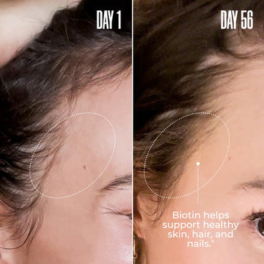 MaÃƒÆ’Ã‚Â«lys Super Charged Liquid Collagen For Women - Collagen Peptides Supplement With Biotin For Hair Skin And Nails - Liquid Hydrolyzed Collagen Peptides