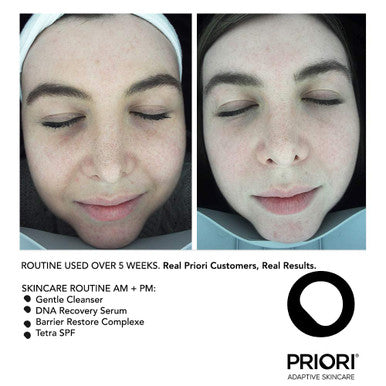 PRIORI Skincare Gentle Face Cleanser with Lactic Acid, Vitamins A, C, E Intense Hydration Light Exfoliation Women and Men All Skin Types Fragrance Free Dermatologist Tested 6 fl oz