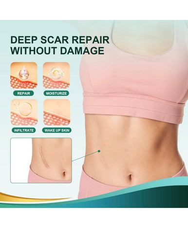 Medical Grade Silicone Scar Sheets, Silicone Scar Tape (1 X 120 , Pack Of 2), Professional Scar Removal Treatment, Reusable Silicone Scar Strip For Keloid, C-Section, Surgery, And Wrinkles