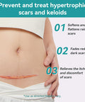 Dimora Waterproof Silicone Scar Sheets - Medical Grade Silicone Scar Tape (1.6 X120" Roll), Ultra-Thin Scar Removal Treatment For Surgical Scars, C Section, Tummy Tuck, Keloid Treatment