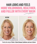 Boldify Thicken Volume Conditioner - Ultimate Biotin Formula for Hair Thickening, Split End Repair, Nourishment, and Fine or Oily Hair for Women & Men