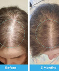 Baby Blues Postpartum Hair Loss Vitamins - Passion Fruit Gummies With Biotin, Collagen, & Folate
