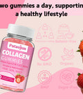 Collagen Gummies Hair, Skin & Nails Gummies With Biotin And Collagen, Vitamin C, E, & Zinc Strawberry Flavored Collagen Gummies For Women Strawberry Flavored 120 Gummies