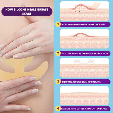 Areola Silicone Scar Sheets For Surgical Scars From Breast Reduction, Augmentation, Lift Or Post Mastectomy - 2 Pack -Reusable And Comfortable Under Post Op Bra