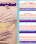 Breast Augmentation Post Surgery Supplies- Silicone Scar Sheets For Breast Surgical Scars-Breast Reduction Recovery Supplies After Surgery Needs- Comfortable Under Post Op Bra