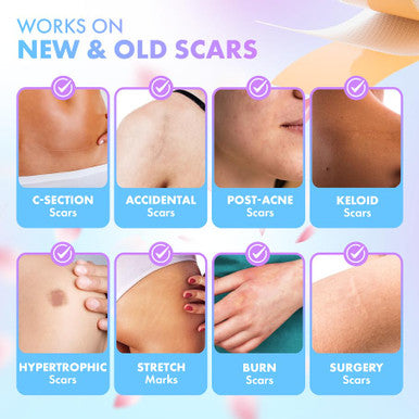 Silicone Scar Tape For Surgical Scars, Keloid, C-Section And More - Silicone Scar Sheets 130 X 1.5 Inch - Effective Scar Treatment And Scar Removal For Face And Body - Silicone Tape For Scars