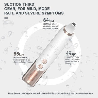 Bug Bite Thing Suction Tool Venom Extractor ZeChok Electronic Mosquito After Bite Sucks Venom, No Antipruritic and Chemical Suitable for Outdoor Camping with 3 Replaceable Tips and Washable (White)