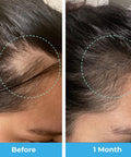 Baby Blues Postpartum Hair Loss Vitamins - Passion Fruit Gummies With Biotin, Collagen, & Folate