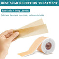 Silicone Scar Sheets - (1.6 X 60 ) Professional Scar Removal Sheets For C-Section, Burn, Acne - Soft Silicone Gel Scar Tape