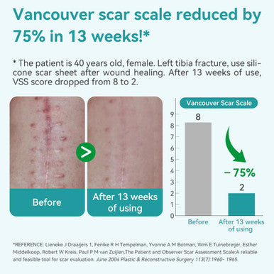 Dimora Waterproof Silicone Scar Sheets - Medical Grade Silicone Scar Tape (1.6 X120" Roll), Ultra-Thin Scar Removal Treatment For Surgical Scars, C Section, Tummy Tuck, Keloid Treatment