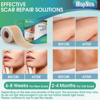 Professional Silicone Scar Sheets (1.6" X 150" Scar Roll-3.8M) - Scars Removal Treatment - Reusable Silicone Scar Tape Strips Type For Keloid, C-Section, Surgery, Burn, Acne Et