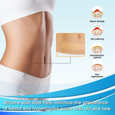 Medical Grade Silicone Scar Tape For Surgical Scars (1.6" X 120" - 3M) Professional Silicone Scar Sheets Scar Treatment For Face Wrinkles, C Section Recovery, Keloid Bump Removal Silicone Scar Patches