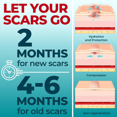 Medical Grade Silicone Scar Tape - 1.6 X150 - Visible Difference On Surgical & Keloid Scars - Reusable Silicone Scar Sheets - Easy To Use Silicone Tape For Scars